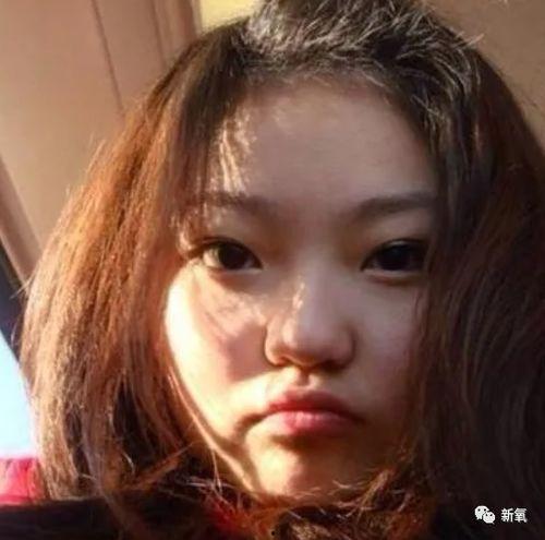 网红孤鸟整容前后,网红整形前后大对比