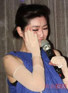 烧伤明星,明星逆境重生之路