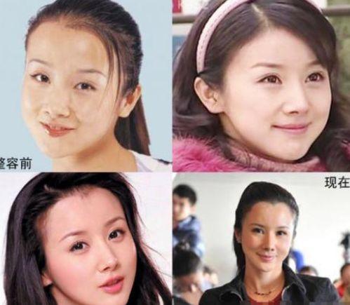 整形失败明星对比照,明星们的美丽代价